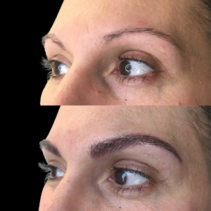eyebrows tatto clinic Oakville