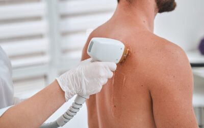 What Should I Expect at My First Laser Hair Removal Appointment?